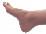 "Male Right Foot 1" by Aleser (Own work) [Public domain], via Wikimedia Commons.